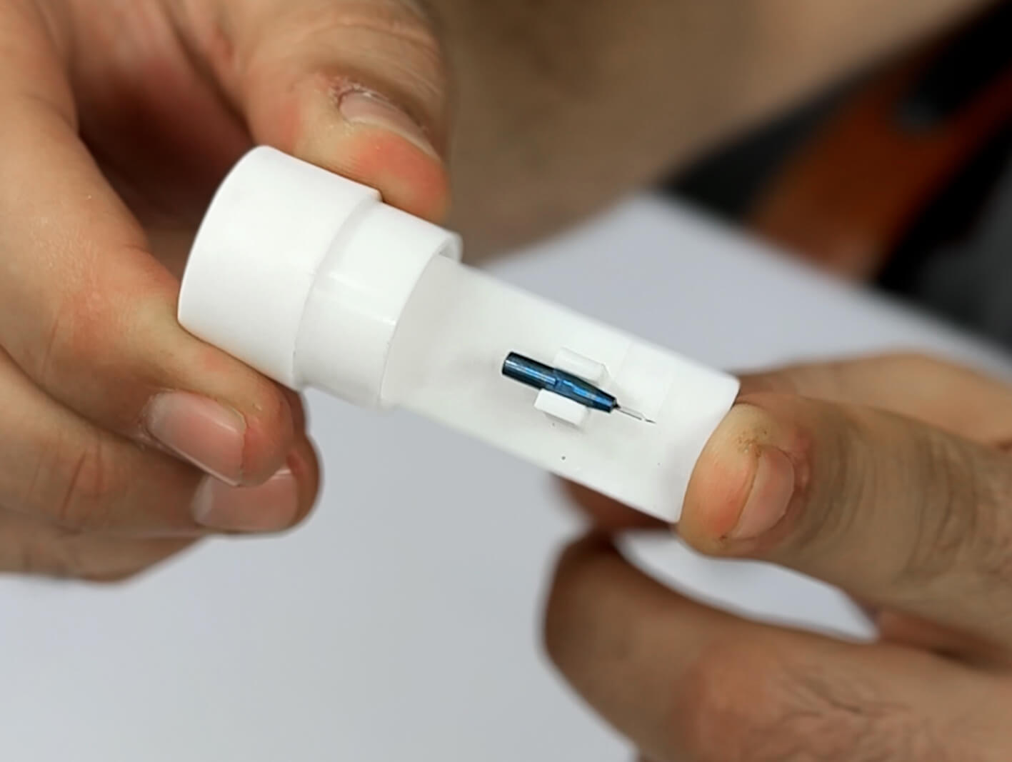 Sapphire FUE hair transplant results